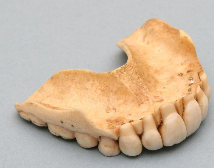 ZahnprotheseMHMBwBAAY0903-1klein ZahnprotheseMHMBwBAAY0903-1klein